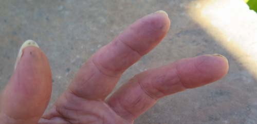 INK REMOVER FOR YOUR HANDS